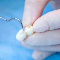 Glass Ionomer for Luting