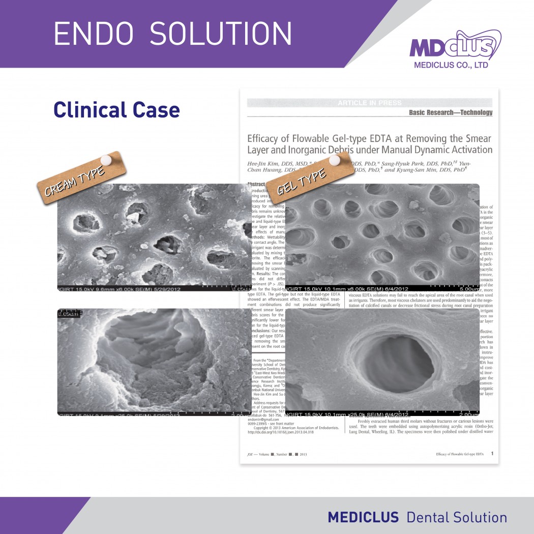 MdClus MD-Solution EDTA