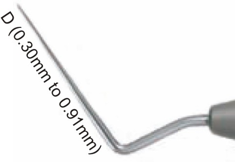 Root Canal Spreaders, 21mm Long, #D11